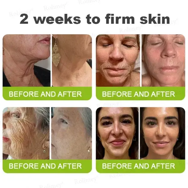 Botox & Vita-A Retinol Firming & Anti-Wrinkle Serum - Image 11