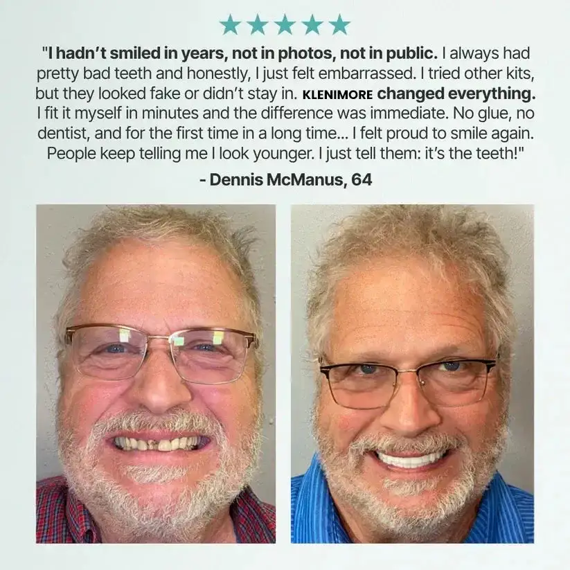 Medical Full Denture with Strong Suctiond - Image 13