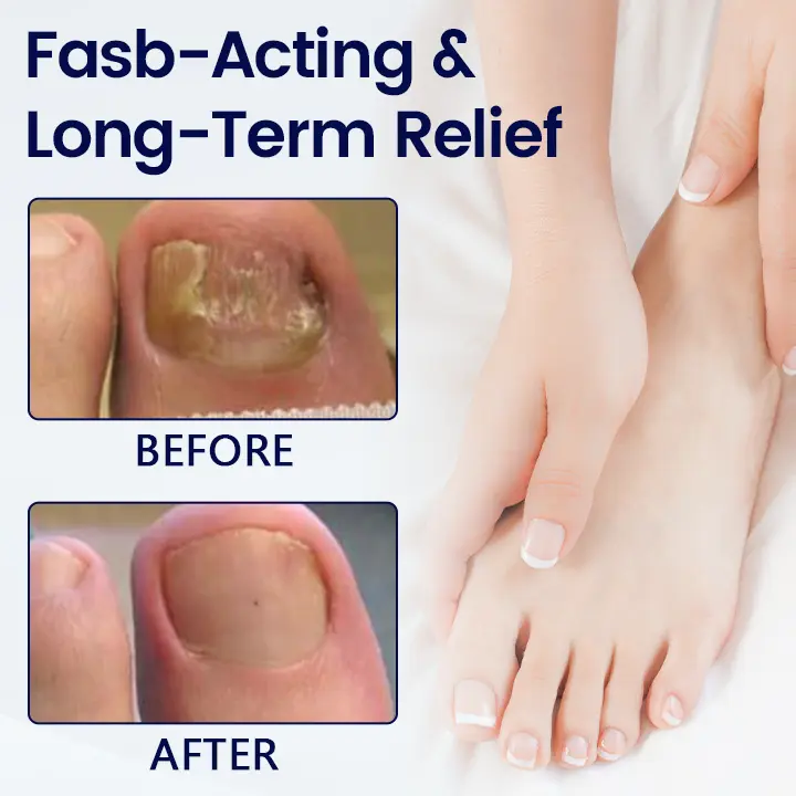 Anti-Fungal Nail Repair Patch - Image 5