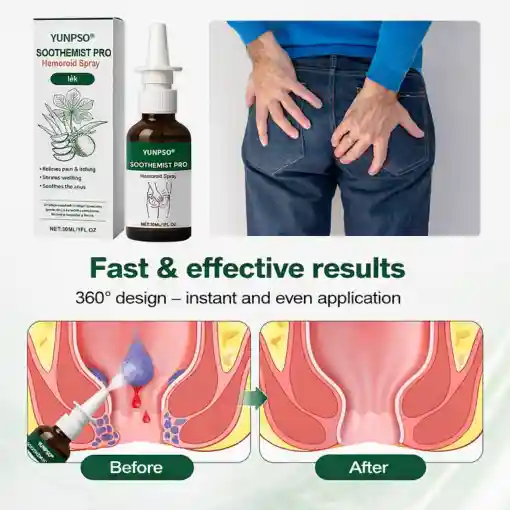SootheMist PRO Hemorrhoid Spray - Image 2