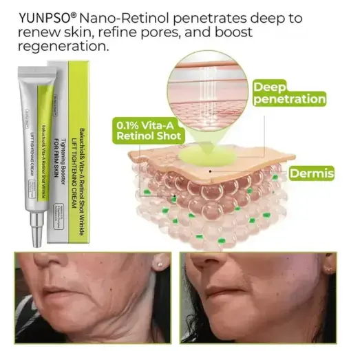 Bakuchiol Vita-A Retinol Shot Wrinkle-Lift Tightening cream – Last Day Promotion 70 OFF - Image 3