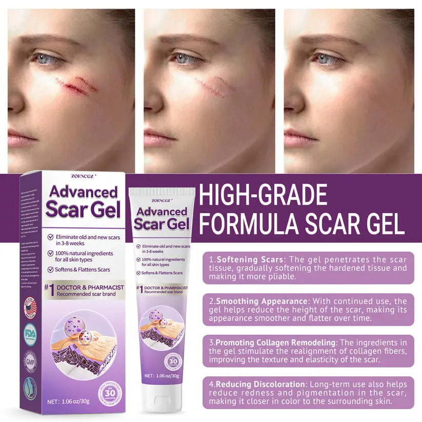 Advanced Scar Gel - Image 6