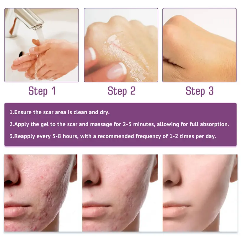 Advanced Scar Gel - Image 7