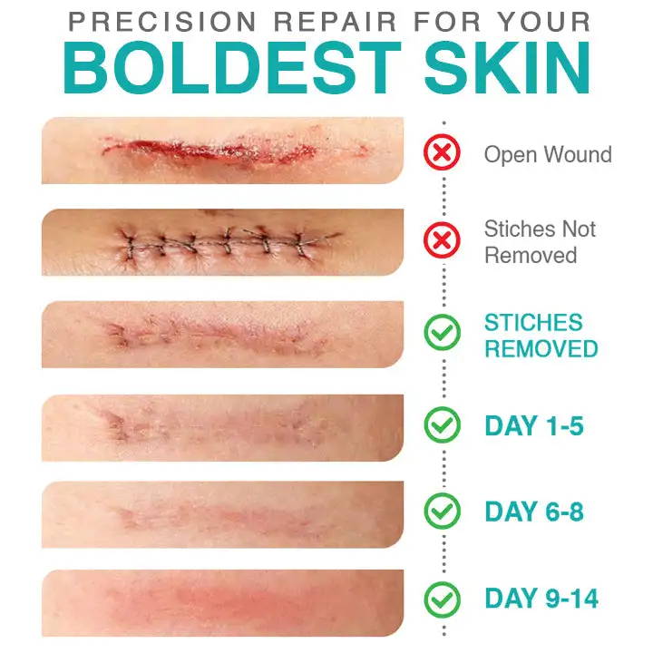 3-in-1 Microneedle Care Patch - Image 4