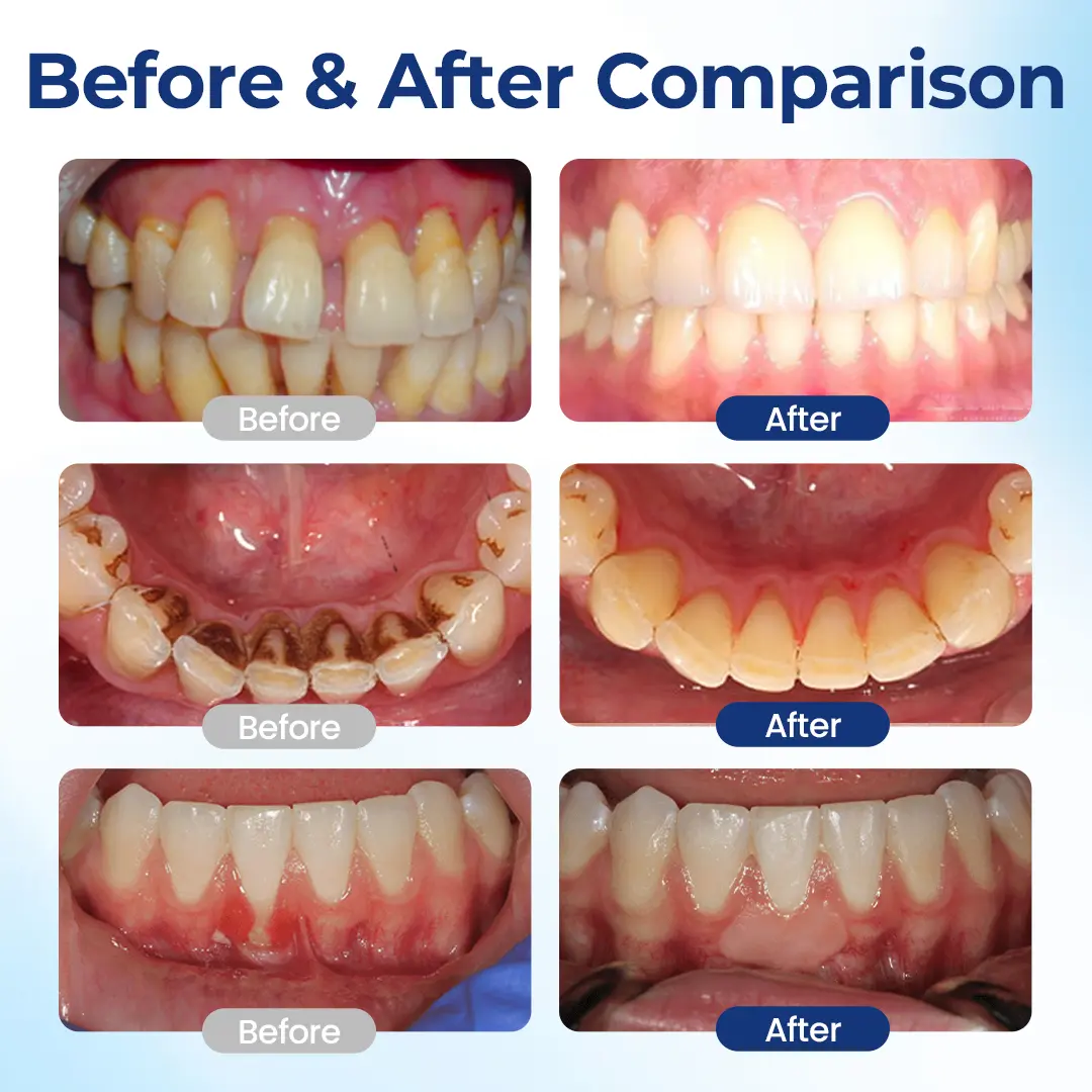 BeeTakt Oral Repair Solution - Image 4
