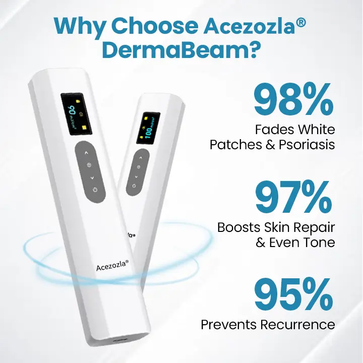DermaBeam Vitiligo Therapy Device - Image 6