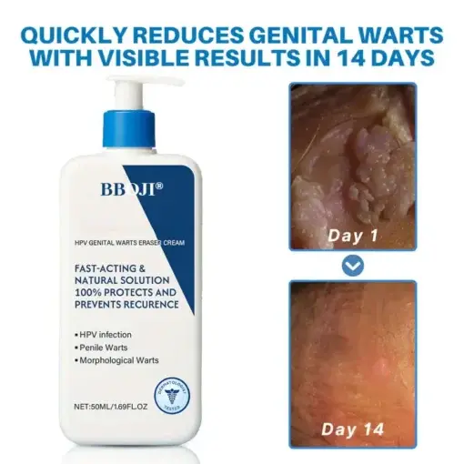 HPV Genital Warts Eraser Cream Ultra - Image 2