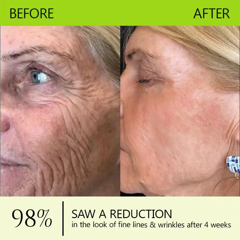 BOTOX & VITA A RETINOL SHOT Wrinkle Lift Tightening Cream - Image 16