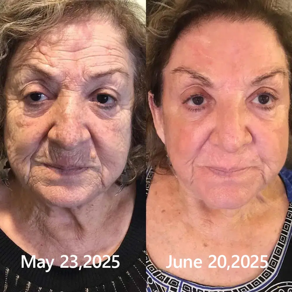 BOTOX & VITA A RETINOL SHOT Wrinkle Lift Tightening Cream - Image 52