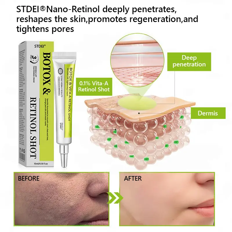 BOTOX & VITA A RETINOL SHOT Wrinkle Lift Tightening Cream - Image 58