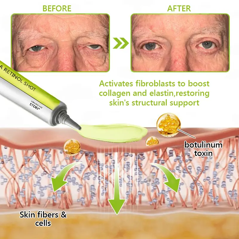 BOTOX & VITA A RETINOL SHOT Wrinkle Lift Tightening Cream - Image 59
