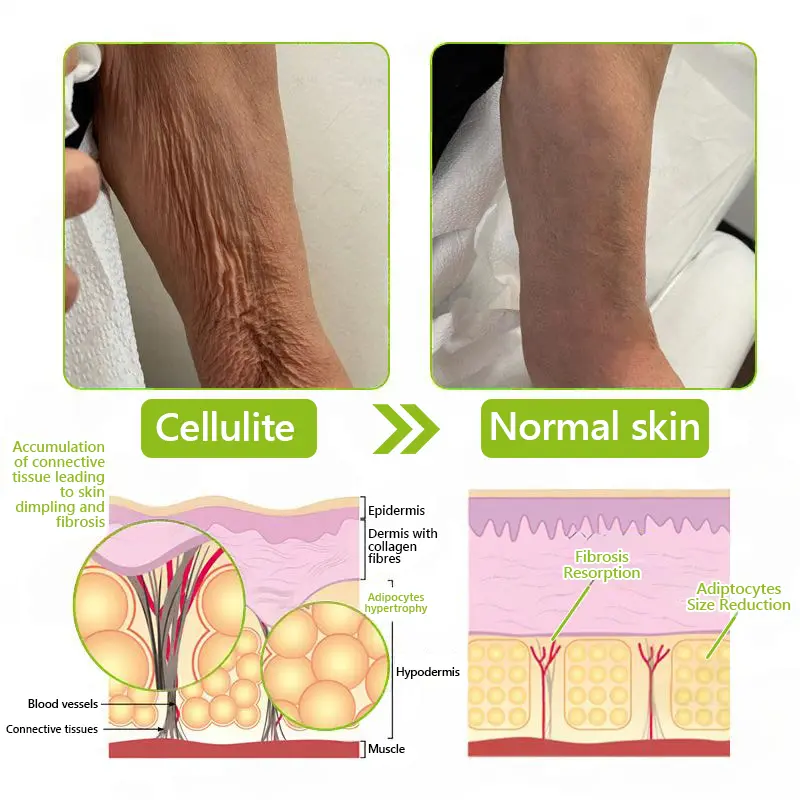 BOTOX & VITA A RETINOL SHOT Wrinkle Lift Tightening Cream - Image 61