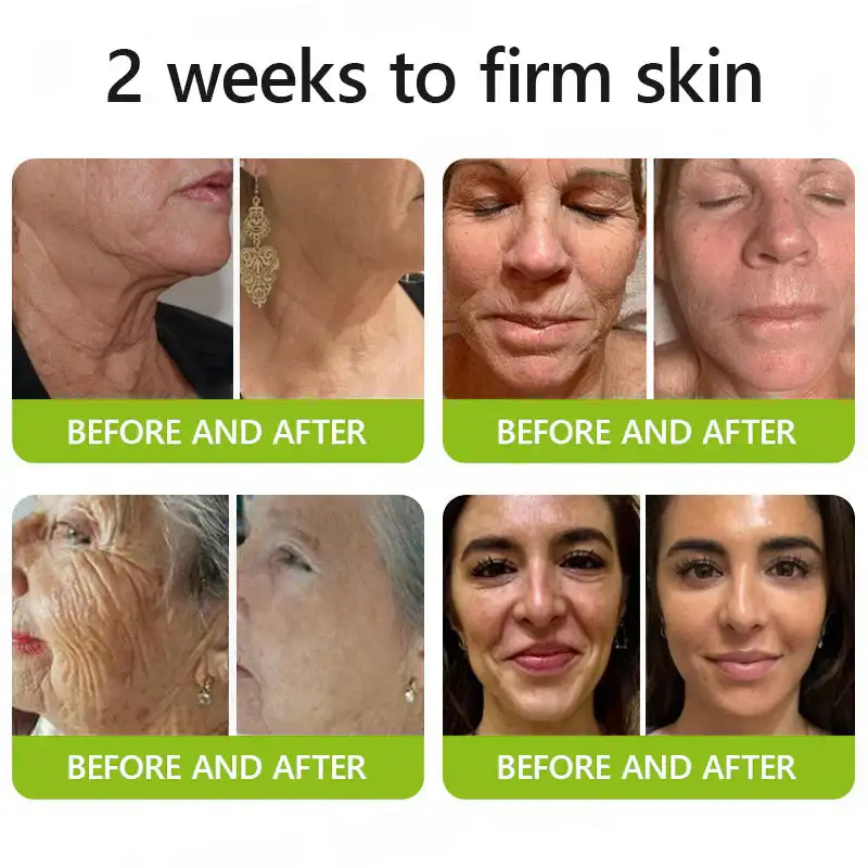 BOTOX & VITA A RETINOL SHOT Wrinkle Lift Tightening Cream - Image 11