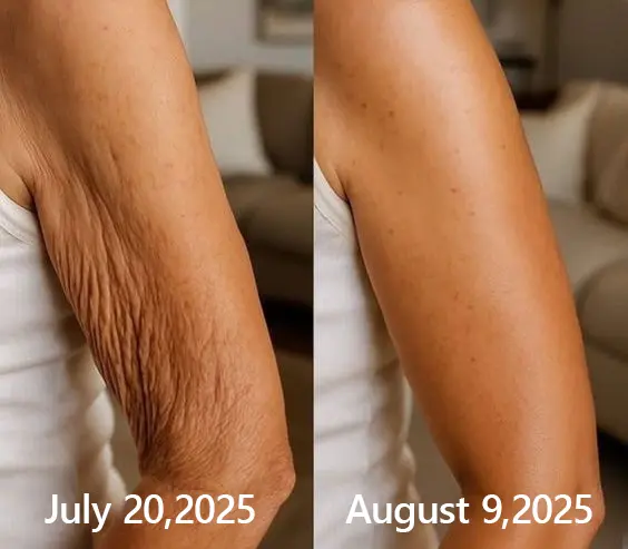 BOTOX & VITA A RETINOL SHOT Wrinkle Lift Tightening Cream - Image 52