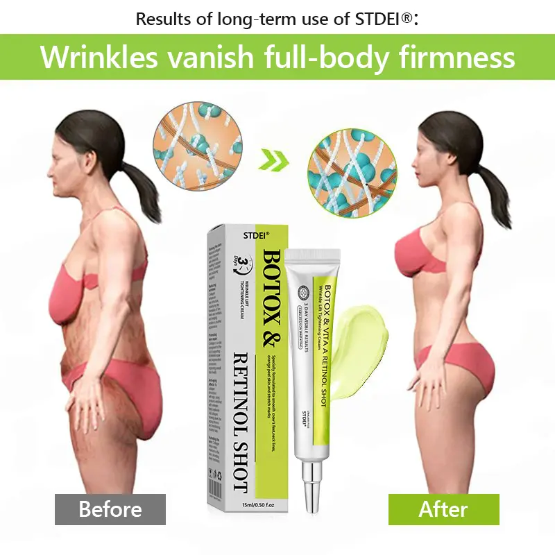 BOTOX & VITA A RETINOL SHOT Wrinkle Lift Tightening Cream - Image 55
