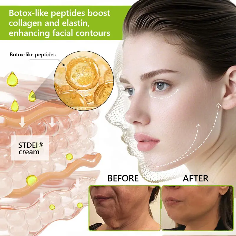 BOTOX & VITA A RETINOL SHOT Wrinkle Lift Tightening Cream - Image 59