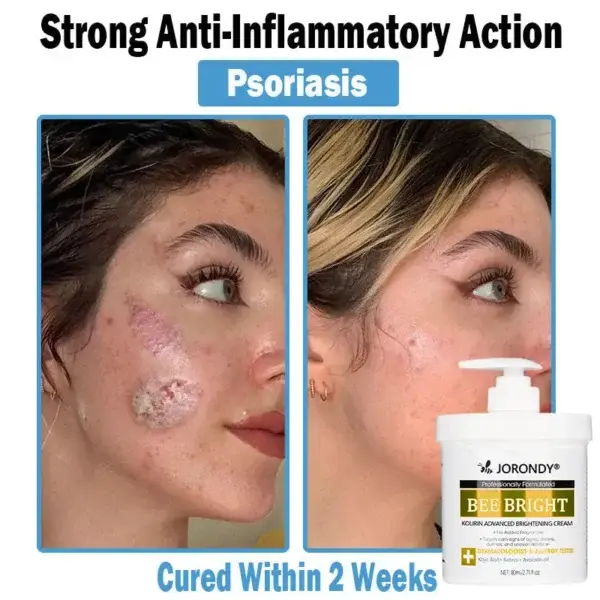 Bee Bright Multi-Symptom Skin Treatment Cream - Image 4