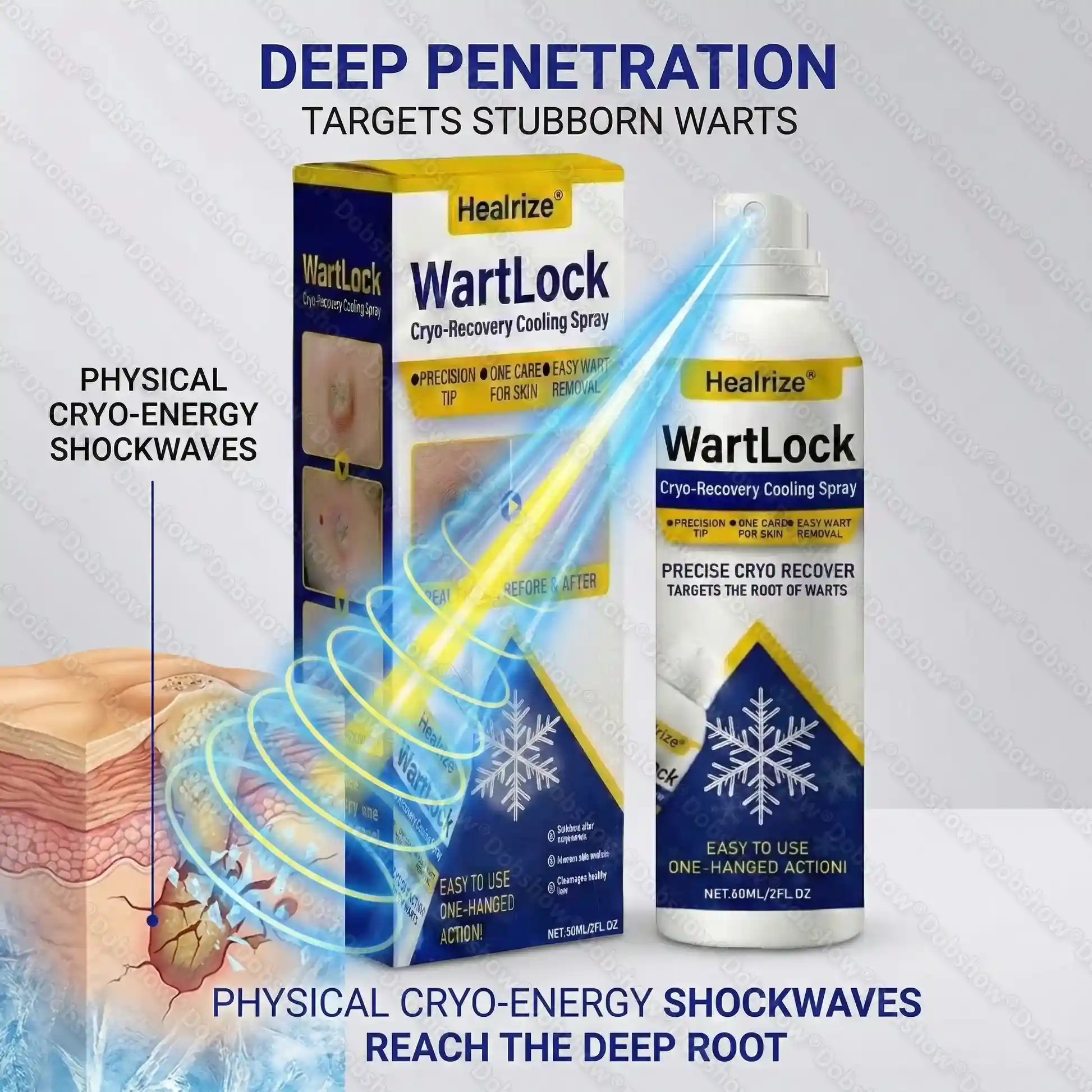 🔥Best WartLock Cryo-Recovery Cooling Spray🎉Special limited-time discount - Image 7
