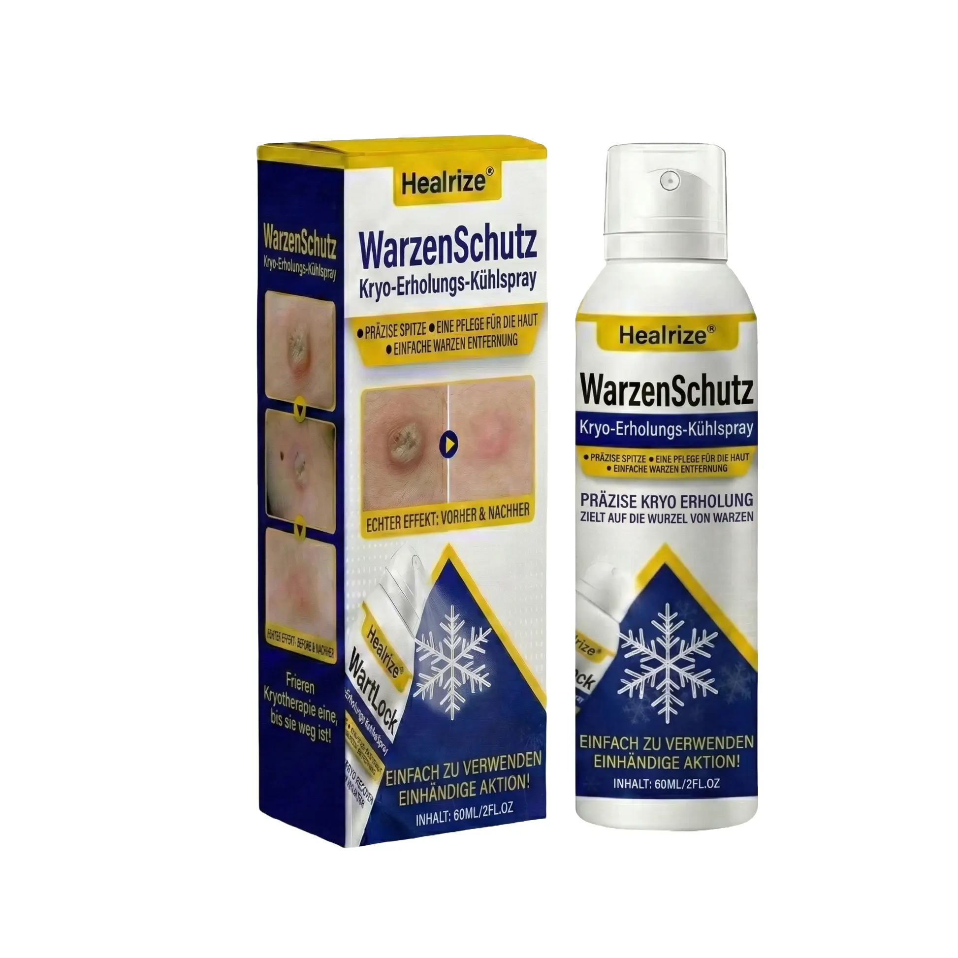 WartLock Kryo-Recovery Kühlspray🎉 Zeitlich begrenzter Sonderrabatt - Image 8