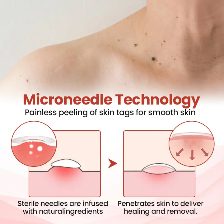 TagDrop Painless Micro Patch - Image 4