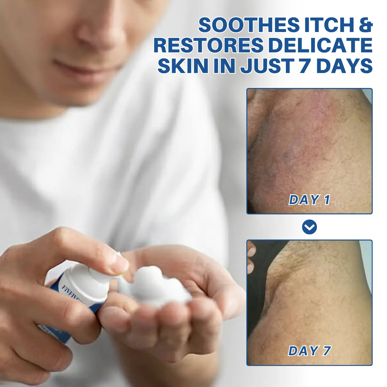 Advanced HPV & Rash Relief Genital Foam - Image 2