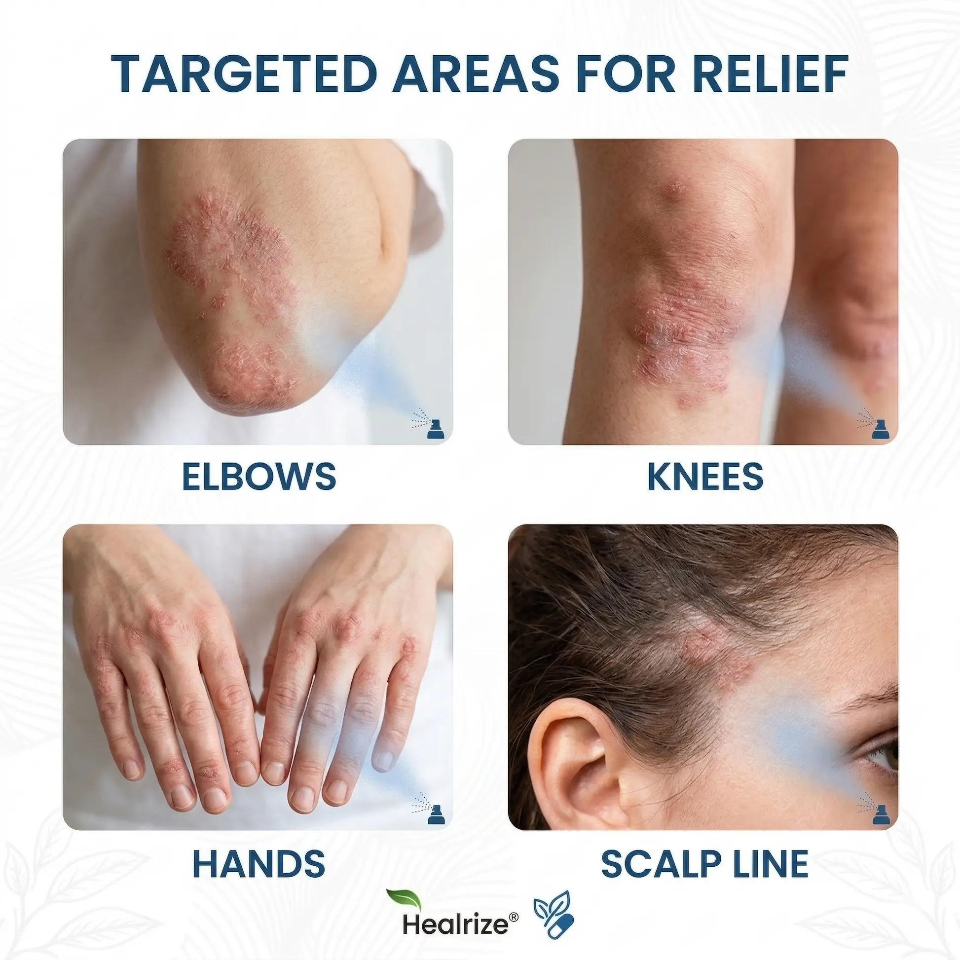 Magnesium Botanical Spray - Image 2