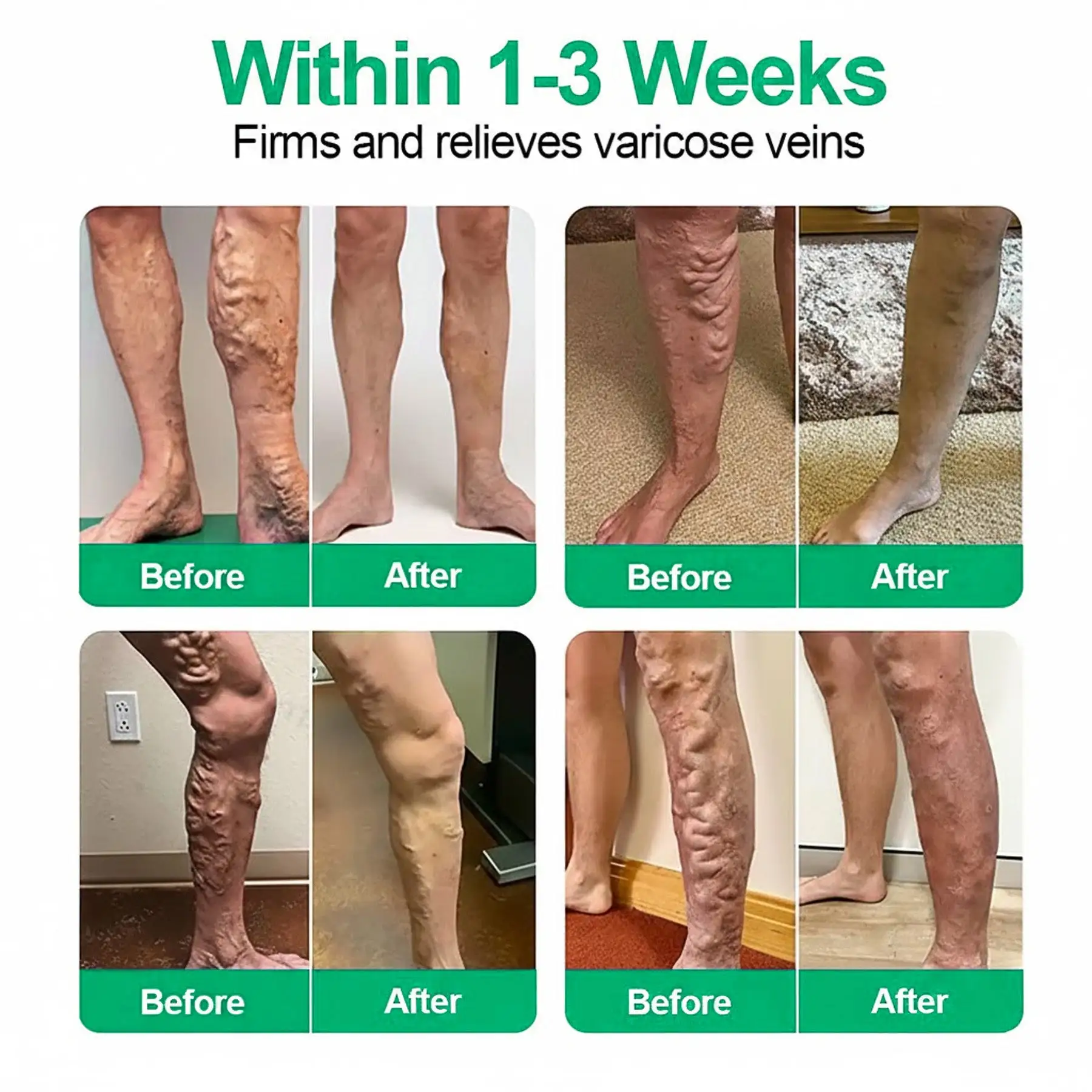 VeinEase Microneedle Care Patch⚡ - Image 3