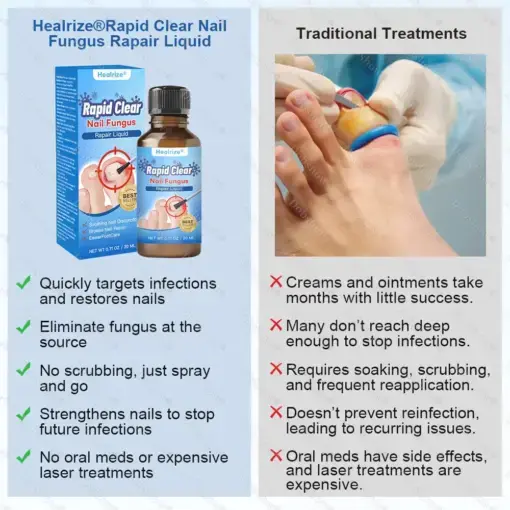 Nano Rapid Clear Nail Fungus Rapair Liquid Effective in 7 Days, Permanently Eliminates the Root - Image 6