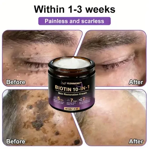 Biotin 10-in-1 Skin Restoration Cream - Image 4