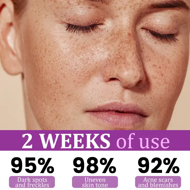 MelantraX Advanced Anti-Hyperpigmentation Essence - Image 5