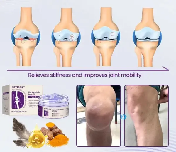 (LAST DAY SALE – 80% OFF) Curcumin & Emu Oil Pain Gel – Backed by US Osteopathic Experts - Image 10