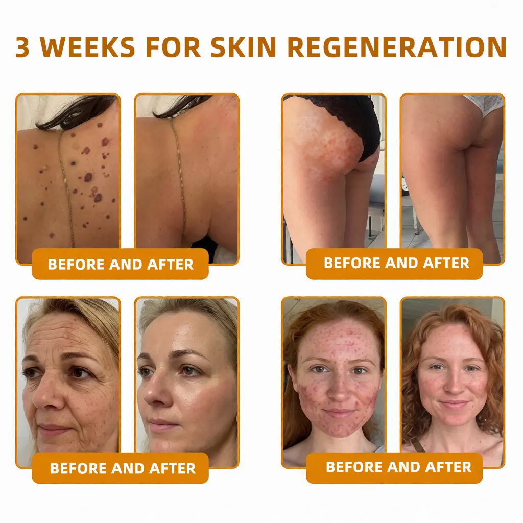 🐝Bee Poison Skin Restoration Cream 🐝 - Image 17