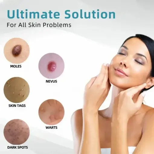 VelvetSkin+ All-in-One Laser Eraser Pen - Image 7