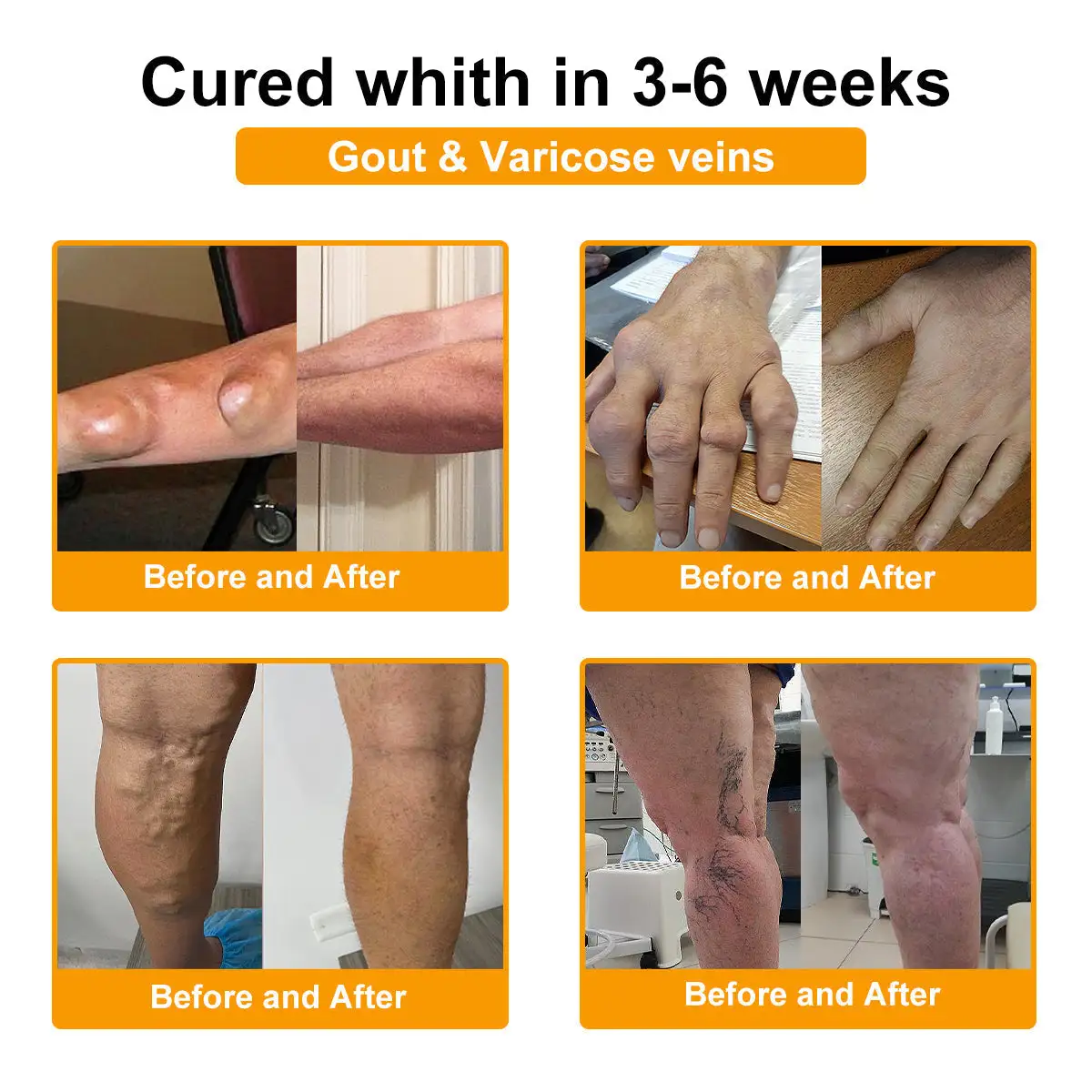 Botulinum Toxin & Bee Venom Pain-Relief Bone Healing Cream - Image 7
