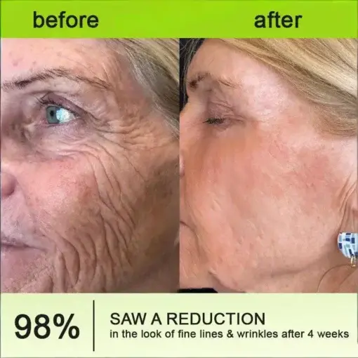 Botin Vita-A Retinol Shot Wrinkle-Lift Tightening cream – Last Day Promotion 70 OFF - Image 10