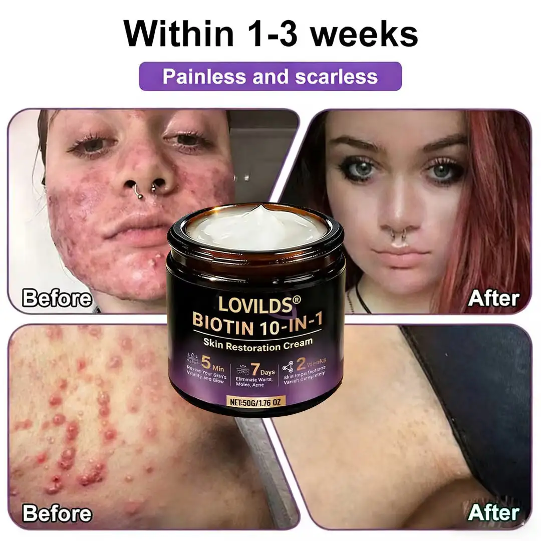 Made and Shipped from UK Biotin 10-in-1 Skin Restoration Cream - Image 4