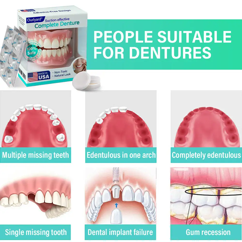 Suction-fit Complete Denture - Image 3