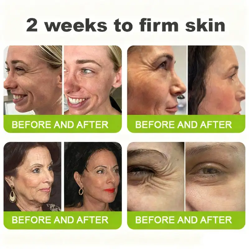 👏🌿 Made in the USA direct shipping Botox Vitamin A Retinol Anti-Wrinkle Firming and Lifting Cream — Last Day for Limited Time 70% OFF - Image 3