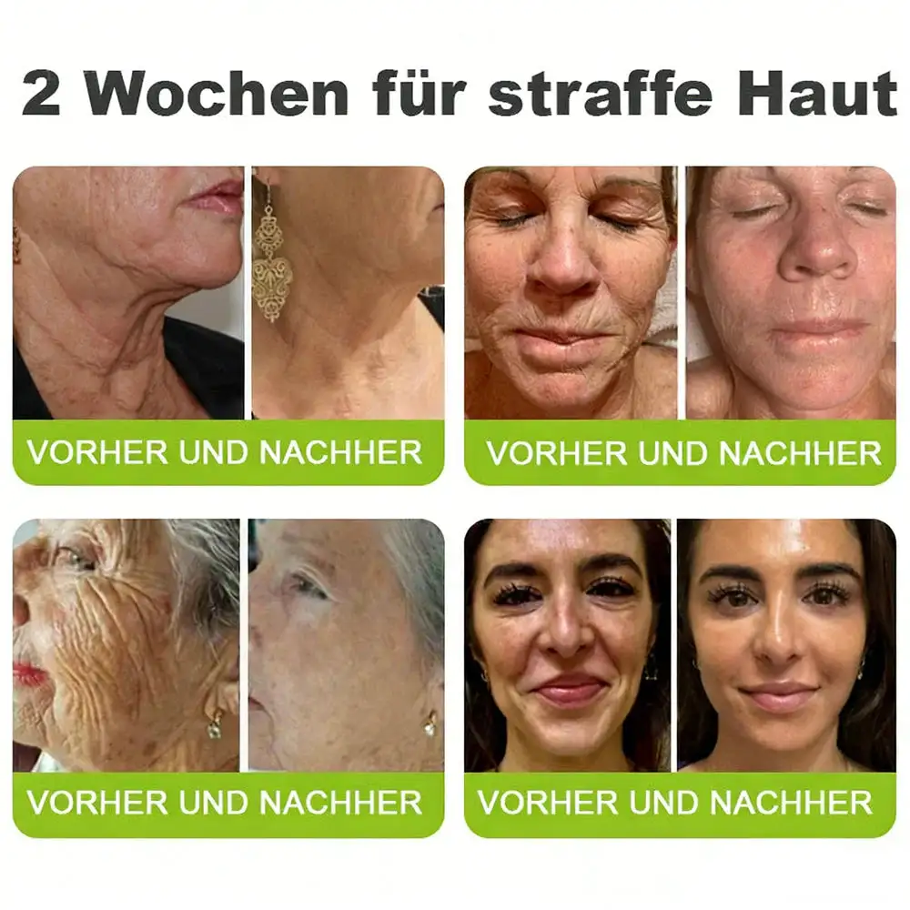 Now regain youthful skin. 💫👨⚕️ NESLEMY ™ Wrinkle relaxer & Vita-A Retinol Shot Wrinkle Lift Firming Cream - Image 7