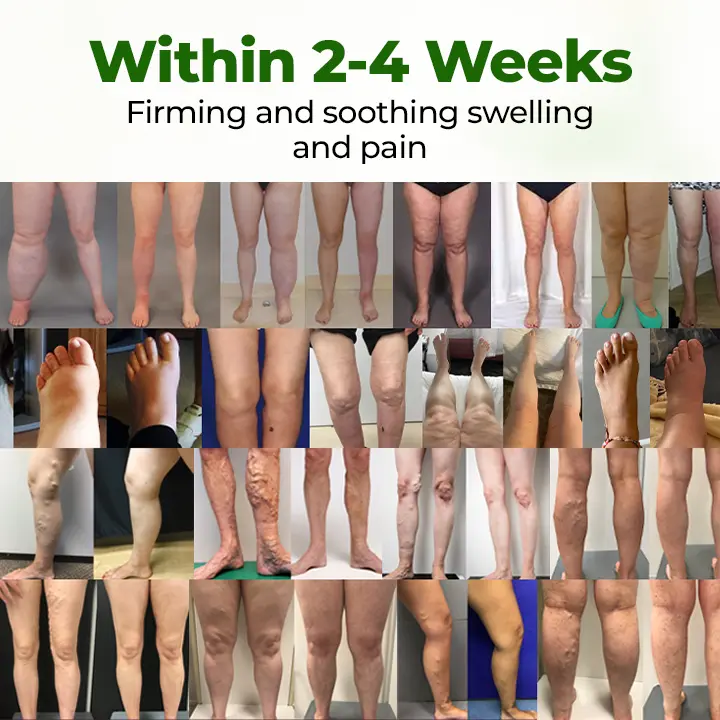 Advanced Leg Circulation Cream - Image 2