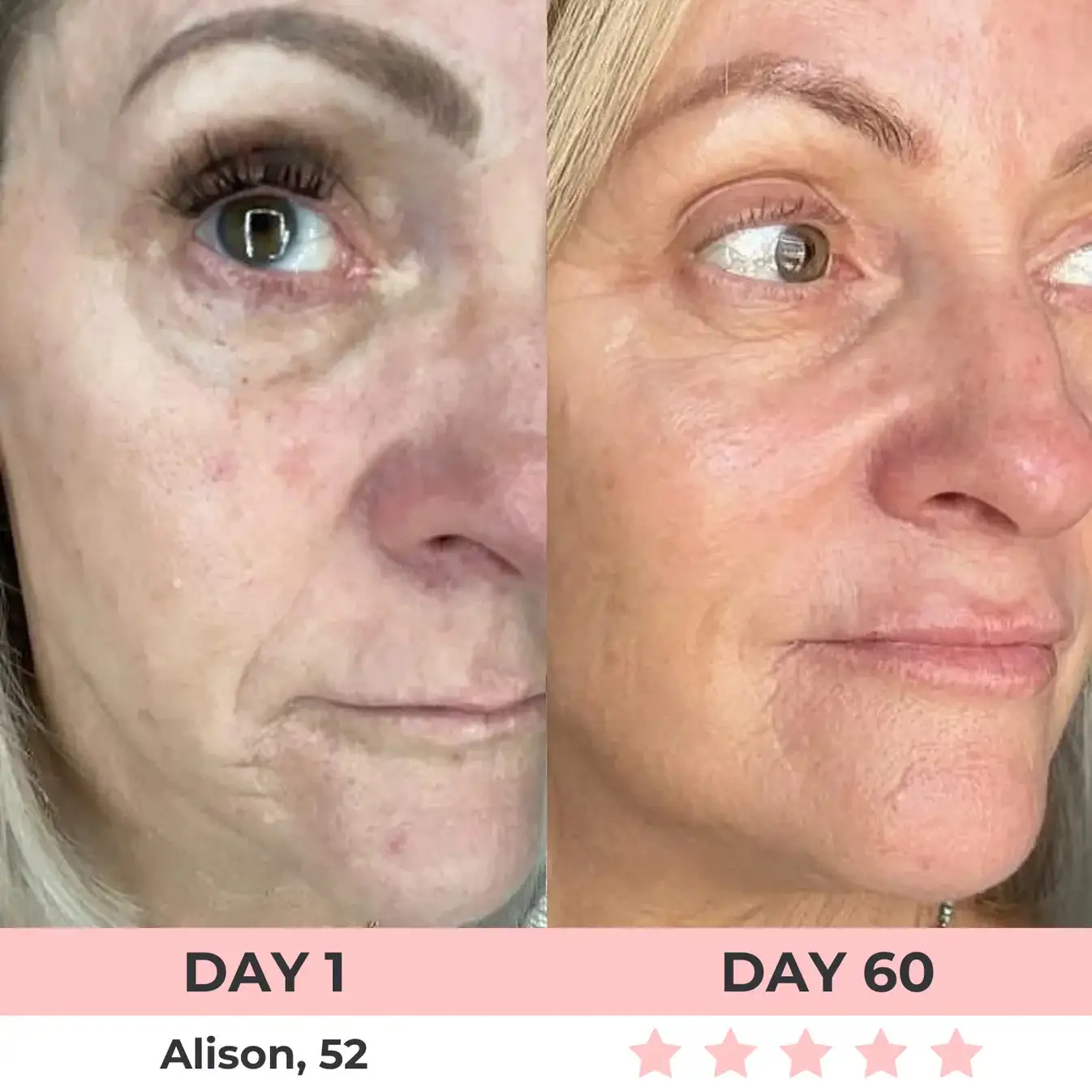 QIAWI 7-in-1 LED Facial Sculptor - Image 11