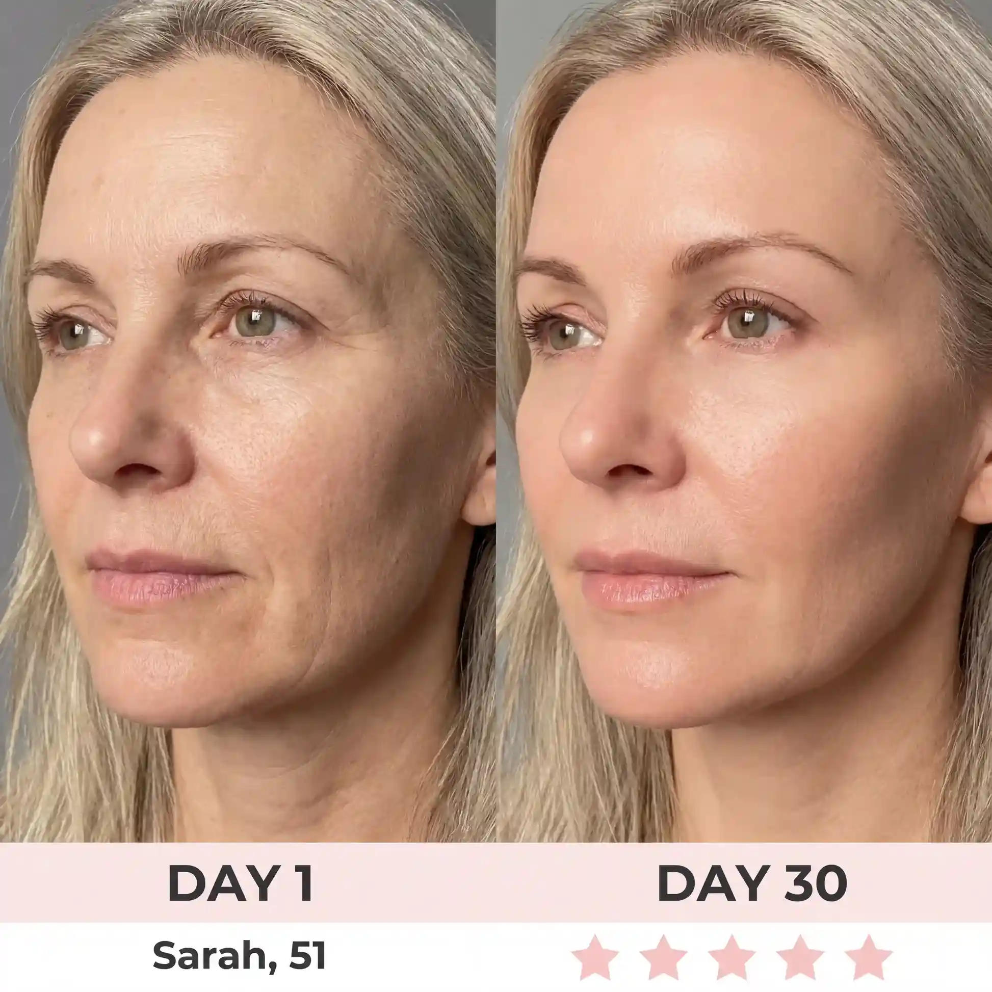 QIAWI 7-in-1 LED Facial Sculptor - Image 5