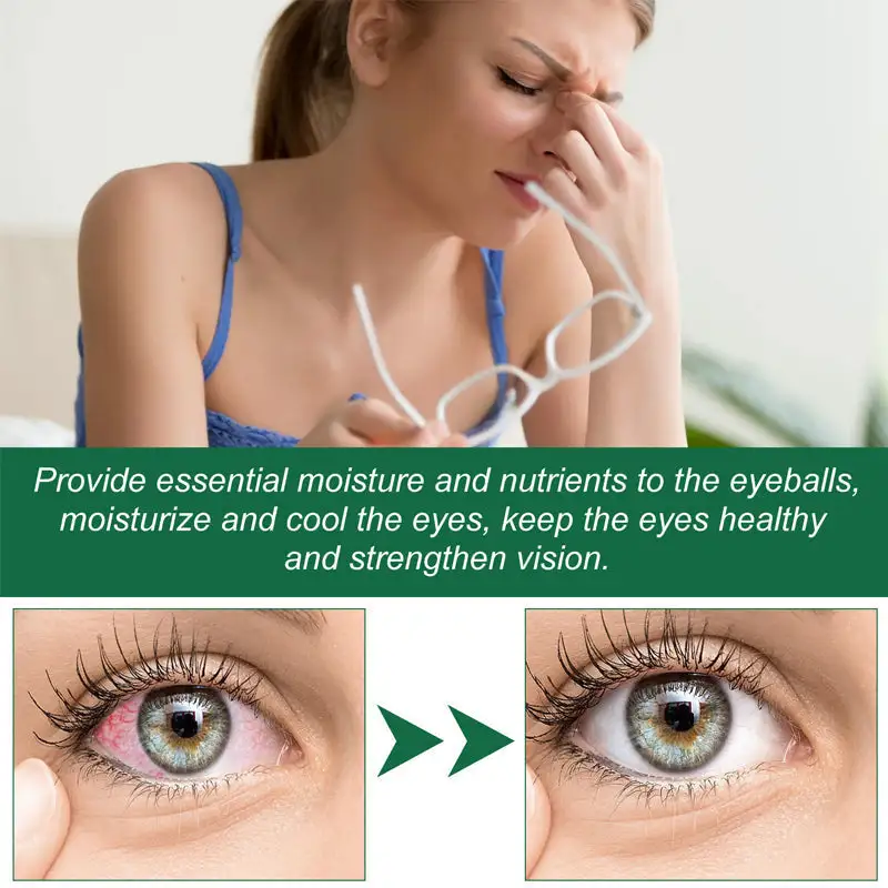 Presbyopia Eye Drops - Image 3
