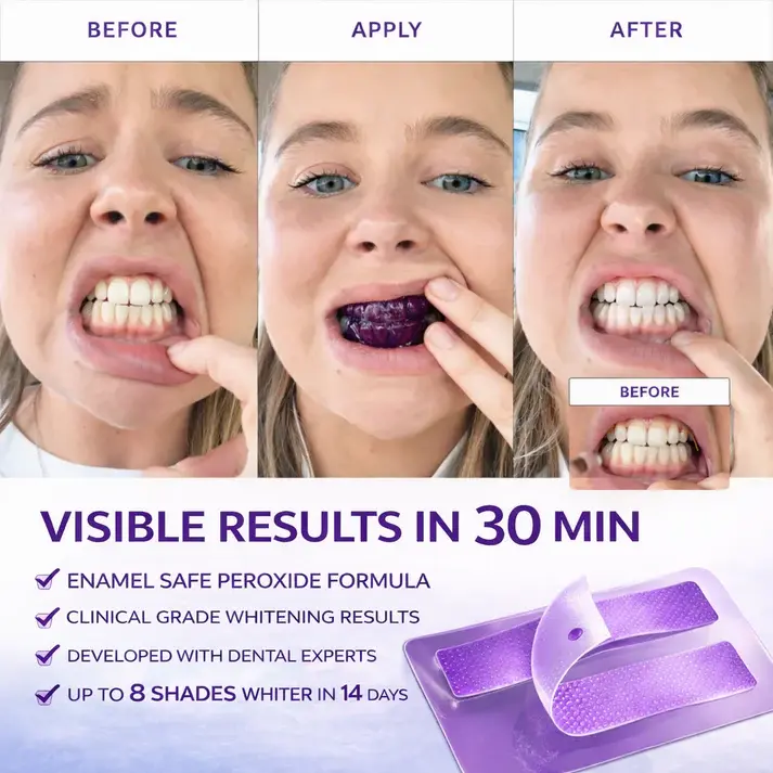 Purple Teeth Whitening Strips - Image 9