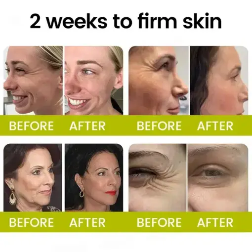 Botox Retinol Shot Smoother-Looking Skin for Deep Lines, Sagging Jowls Puffy Eyes - Image 3