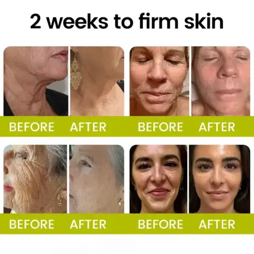 Botox Retinol Shot Smoother-Looking Skin for Deep Lines, Sagging Jowls Puffy Eyes - Image 2