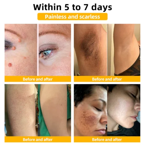 Bee Venom Advanced Skin Repair Cream - Image 4