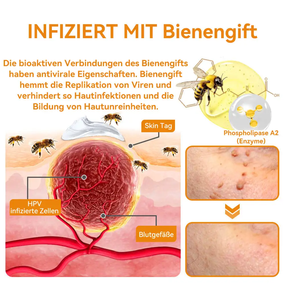 Bienengift Waren & Muttermalenfernung Creme - Image 8