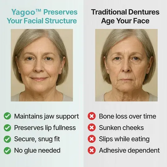 Custom Custom-Fit Full Functional DenturesMake you more confident - Image 6