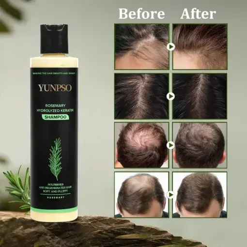 YUNPSO Organic Rosemary Hair Growth Shampoo Hair Conditioner - Image 3